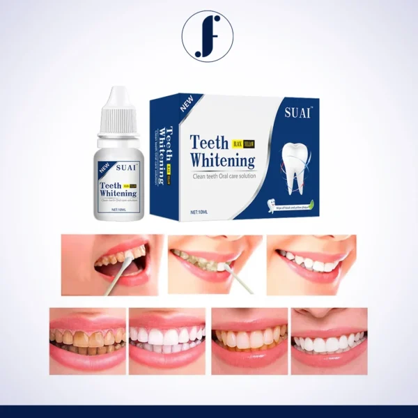 Natural-Herbal-Dental-Cleaning-Solution-for-Removing-Tartar-Smoke-Stains-Whitening-Teeth-3